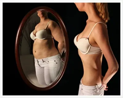 Body Dysmorphic Disorder