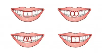 Ý nghĩa của răng trong nhân tướng học