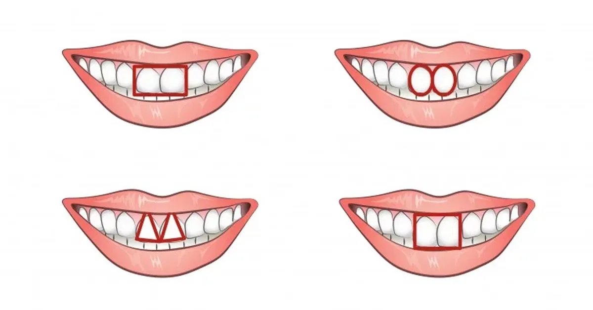 Ý nghĩa của răng trong nhân tướng học