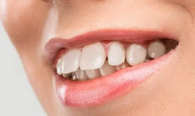 Nhìn tướng răng xem vận giàu nghèo