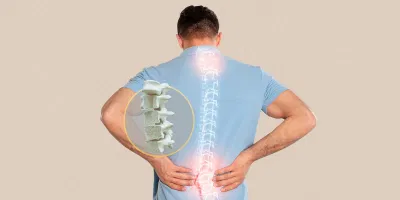Hơn 80% người dân Việt Nam không bổ sung đủ canxi