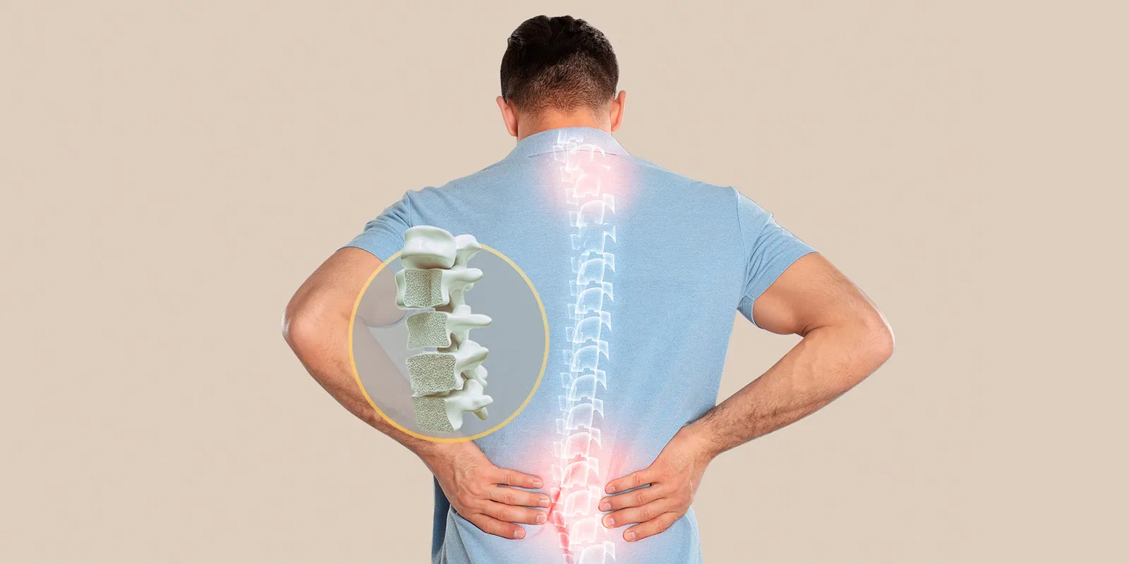 Hơn 80% người dân Việt Nam không bổ sung đủ canxi