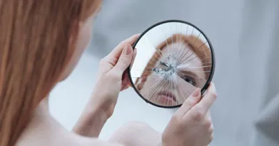 Body Dysmorphic Disorder