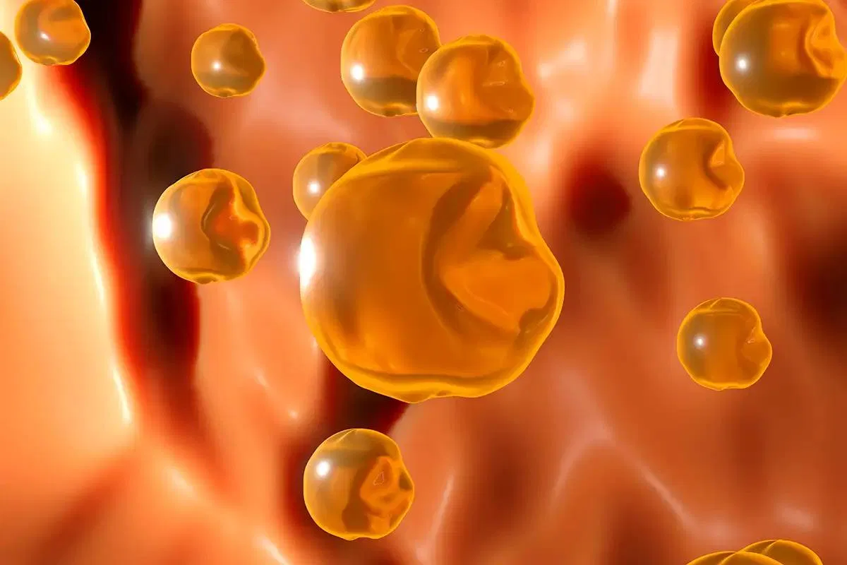 Cholesterol