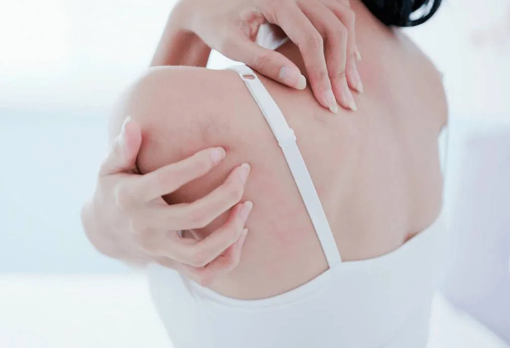 Việc phân biệt mề đay với các loại phát ban da khác không phải lúc nào cũng dễ dàng