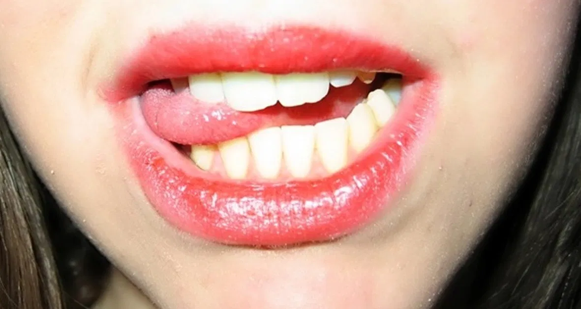 Thường xuyên cắn vào lưỡi có nguy hiểm không?