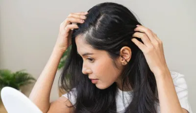 Hầu hết các trường hợp, gàu có thể được kiểm soát dễ dàng tại nhà bằng các sản phẩm phù hợp
