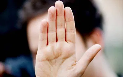 Lòng bàn tay, bàn chân bị vàng