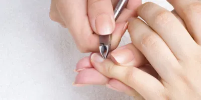 Cắt bỏ vùng da bị bong và dưỡng ẩm