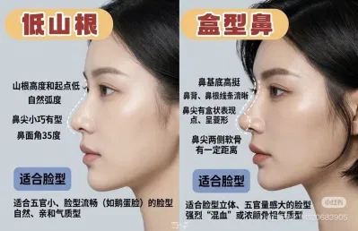 Dáng mũi sơn căn thấp