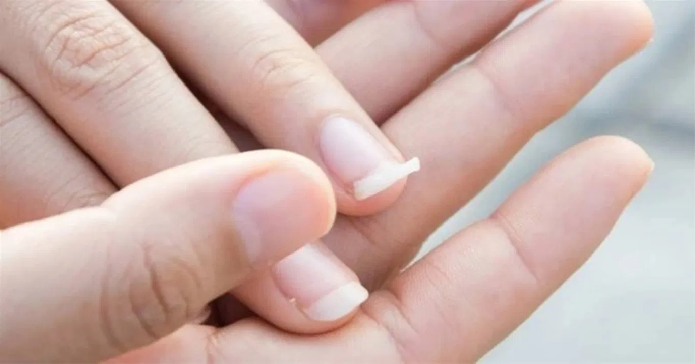 Móng mỏng, yếu, dễ gãy