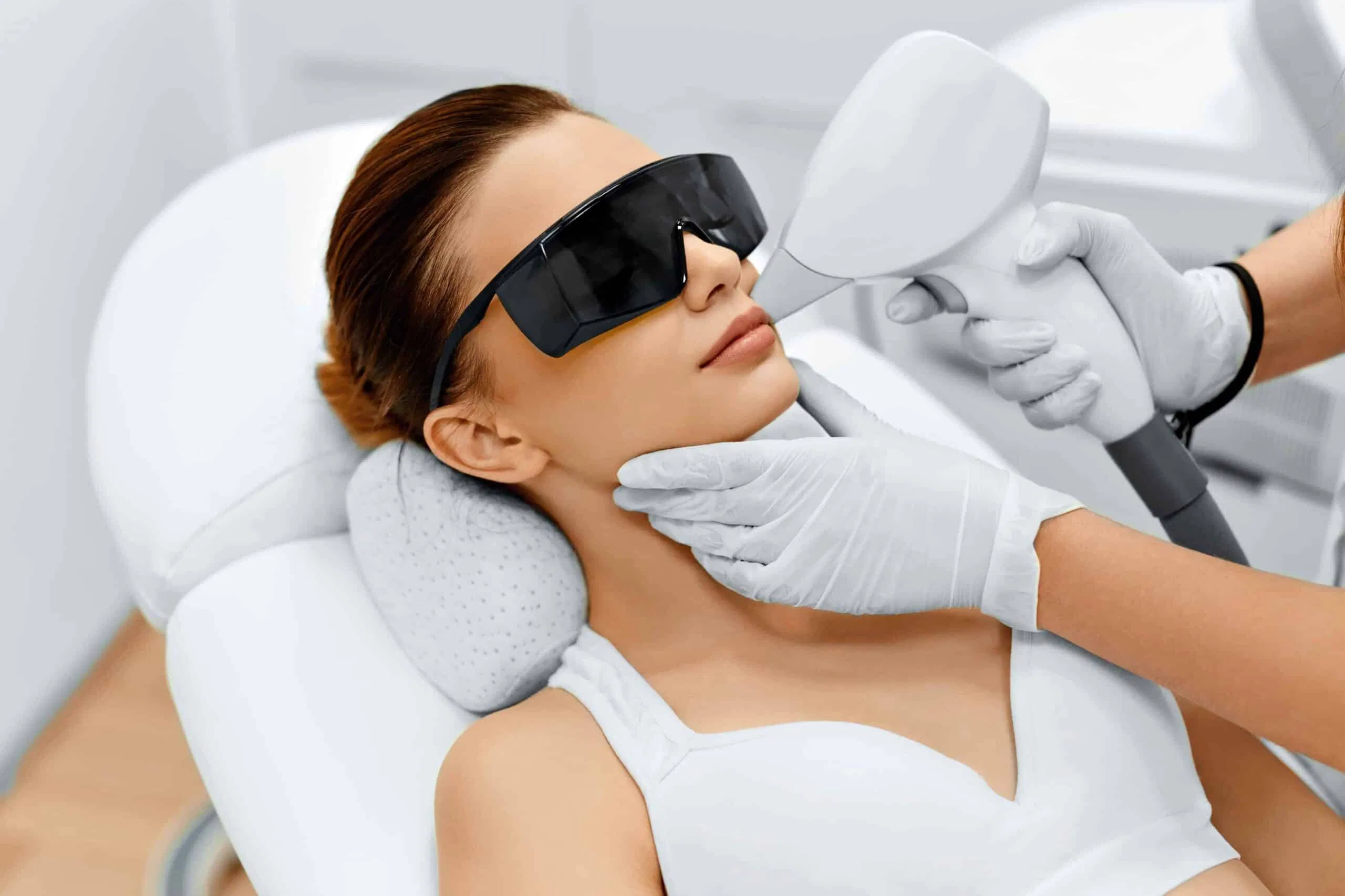 Triệt lông bằng laser